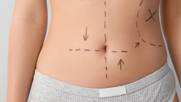 أشهر ٧ عمليات تجميل في كوريا الجنوبية! (مع الصور) 